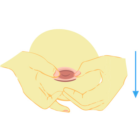 Correct Inverted Nipples - Surgery vs Nonsurgical Methods - Dr. Chen Lee